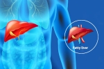 Fatty Liver Disease News health, Fatty Liver Disease News latest, body organs that can be affected by fatty liver disease, Excessive drinking