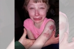 lilly special needs child, Lynn Waldron-Moehle, 10 year old special needs child brutally bitten on arm while returning home in school bus, Special needs