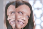 Deepika Padukone latest updates, Deepika Padukone new movie, first look of deepika padukone as acid attack survivor, Padmaavat