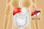 Fatty Liver, Fatty Liver cure, dangers of fatty liver, Obesity
